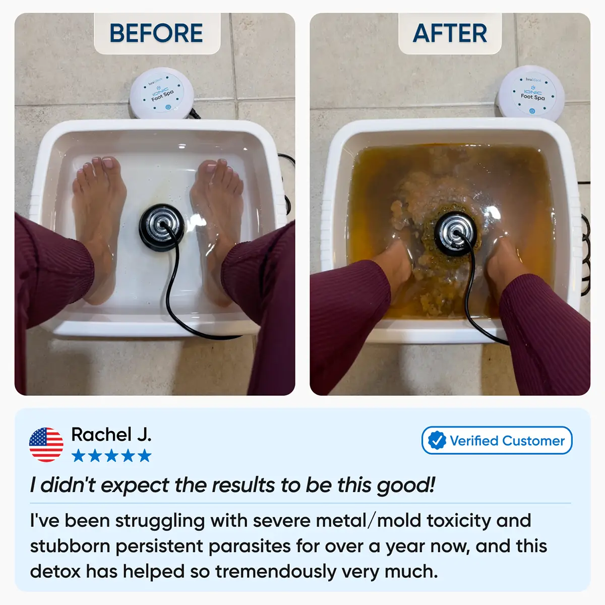 Purionix RX — Ionic Foot Detox System